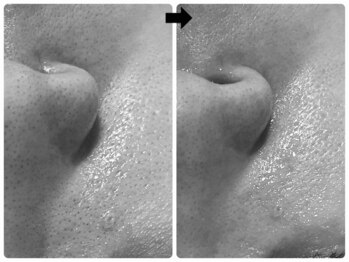 エフェクト 塚口店(effect)/Before After 40代/3回目