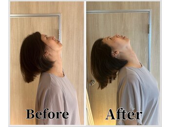 整体ラルース 中目黒(LALUZ)/50代 女性 ストレートネック改善