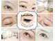 ルナベル(Lunabelle)の写真