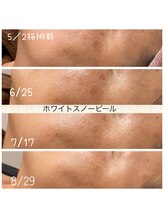 ココ 2号店(CoCo)/ホワイトスノーピール