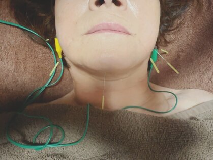 カナデ(kanade)の写真