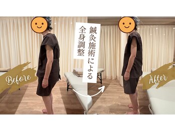 エヌアンドエヌ鍼灸院 福住店(N&えぬ鍼灸院)/鍼灸・整体 Before & After