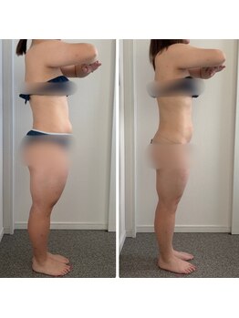 グレース(Grace luxe)/ブライダルダイエット♪