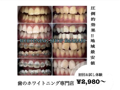 ホワイトニングショップ 今治店の写真