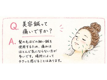 マーキュリー(Mercury)/美容鍼って痛いですか?