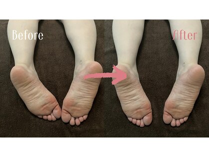 アサヅキ(ASAZUKI)の写真