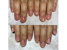 自爪を育てて褒められちゃう指先に