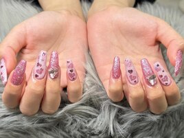 チップスカルプ150分