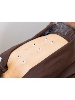 冷え改善・代謝をUPしたい