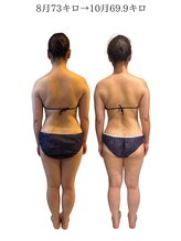 エスエー(SA)/Before/after