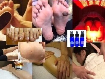 ビサンテ サロンの写真/Footケアの角質ケア,自爪ケア超人気!足&美脚,全身に[足裏/むくみ/O脚/首・肩こり]3D足バランス&マシン&整体