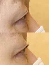 ダーム ド ローズ(Dame de rose)/【まぶたが上がるまつ毛パーマ】