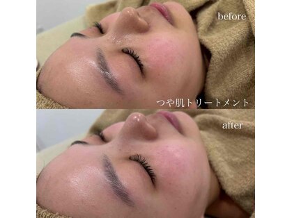 リグレイス(Re.Grace)の写真