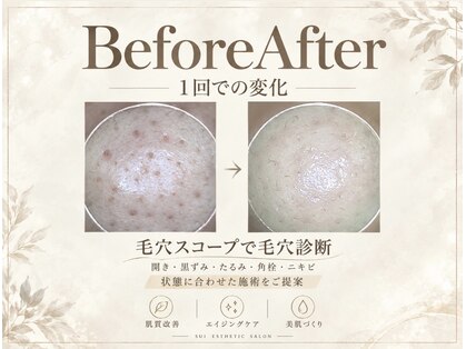 スイ(sui)の写真