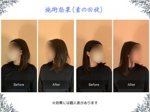 ボディ リセット アンド デザイン(Body Reset & Design)/【施術例】ビフォーアフター