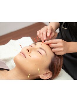 鍼灸施術を受けたい