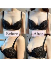 ハイファイブ(Hi-Five)/バストアップ/（施術4回）