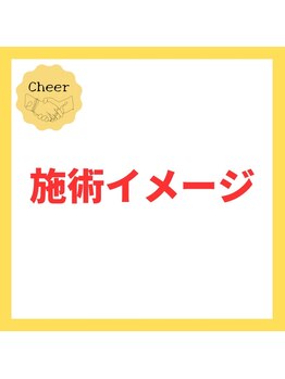 チア(Cheer)/施術イメージ