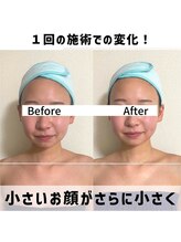 お顔の研究所/ビフォーアフター写真♪
