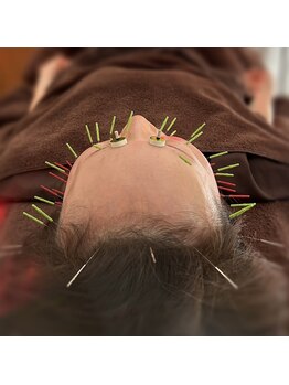 シンシンラボ 豪徳寺(SHINSHIN Lab)/季節の変わり目の揺らぎ肌に。