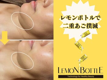 エスプリ 新宿店/レモンボトル・小顔脂肪分解