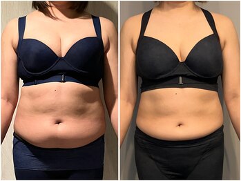 インプルーブ 浜北店(Improve)/体重-5.4kg！　30代女性