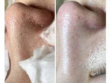 エヌエクラ(N.eclat.)/透明感爆誕