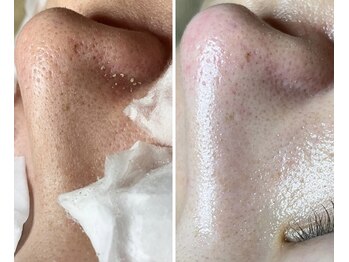 エヌエクラ(N.eclat.)/透明感爆誕