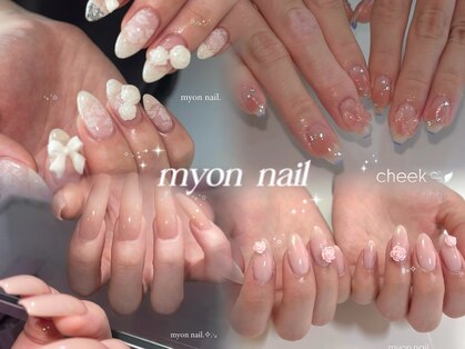ミョンネイル(myon nail)の写真