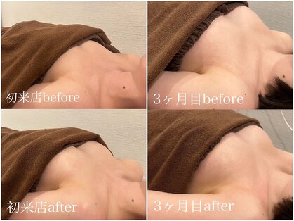 ビュエル(Beauel)の写真