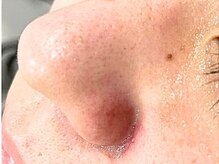 ピナリ(PINARI)の雰囲気（韓国で最新の毛穴洗浄ができる【ニキビ/小顔矯正/フェイシャル】）