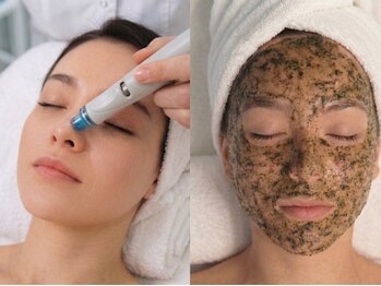 ライム 立川(LIME)の写真/毛穴詰まり&黒ずみ徹底改善!!【剥けないハーブピーリング×毛穴洗浄】ダウンタイム無しで即毛穴レス美肌☆