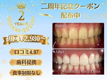 ホワイトニングショップ 多摩店