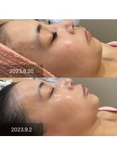 ジャストミービューティー(Just Me Beauty)/リアボーテハーブトリートメント