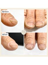 カロッス(Kallos)/自爪育成　