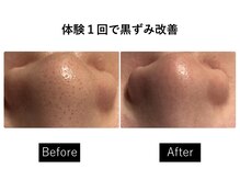 ナチュラーレ 梅田店(Naturale)/美肌ニキビケア小顔フェイシャル