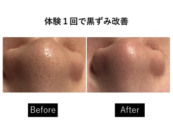 ナチュラーレ 梅田店(Naturale)/美肌ニキビケア小顔フェイシャル