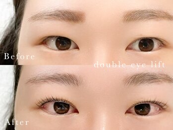 アンナ 仙台広瀬通店(Anna)/ 業界最新技術ダブルアイリフト