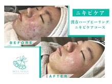 ベルスタイル(Bell style)/当店のお客様症例(ハーブ)