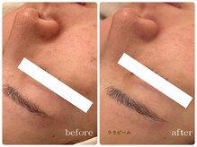 メゾンリュバン 梅田店(Maison Ruban)/ララピール｜毛穴・ツヤ