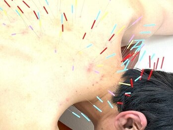 とだ鍼灸院の写真/理学療法士/鍼灸師/柔道整復師の資格保有『首・肩こり・腰痛改善に特化した鍼灸』で諦めていた症状も解消◎