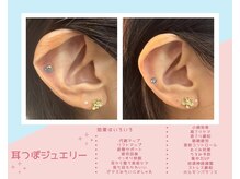 丸太町骨盤整骨院 鍼灸院/耳つぼジュエリー