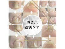 まずはお気軽にカウンセリングから♪