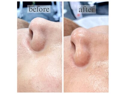 アイザ ビューティ(AIZA BEAUTY)の写真