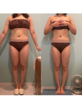 エクラ(Eclat)/Eclatの痩身★BeforeAfter1