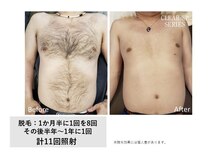 ディーエムピーコネクト(dmp connect)/