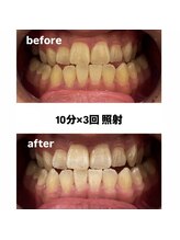エム(M)/症例写真