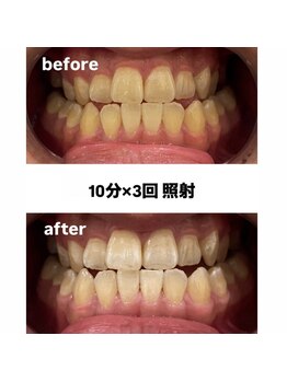 エム(M)/症例写真