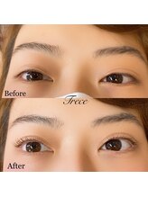 トレセ 尾山台(Trece)/まつ毛パーマ