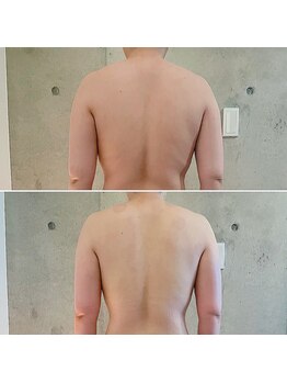 サプナジー(Suppnrgy)/カスタムトリートメント